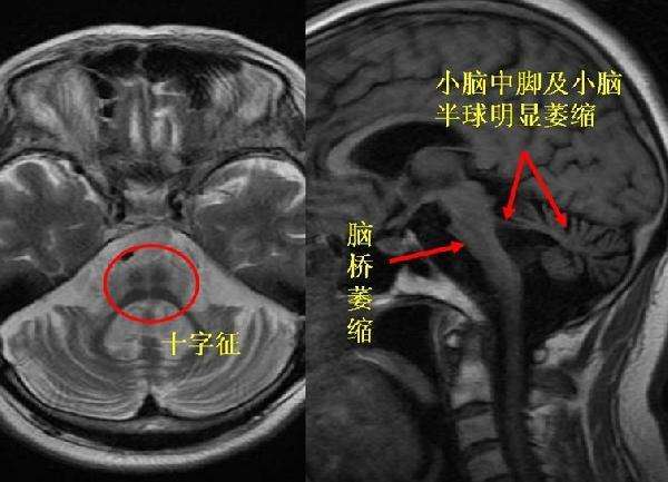 经常头晕走路身体感觉晃动怎么办,走路不稳头晕身体摇晃是什么原因