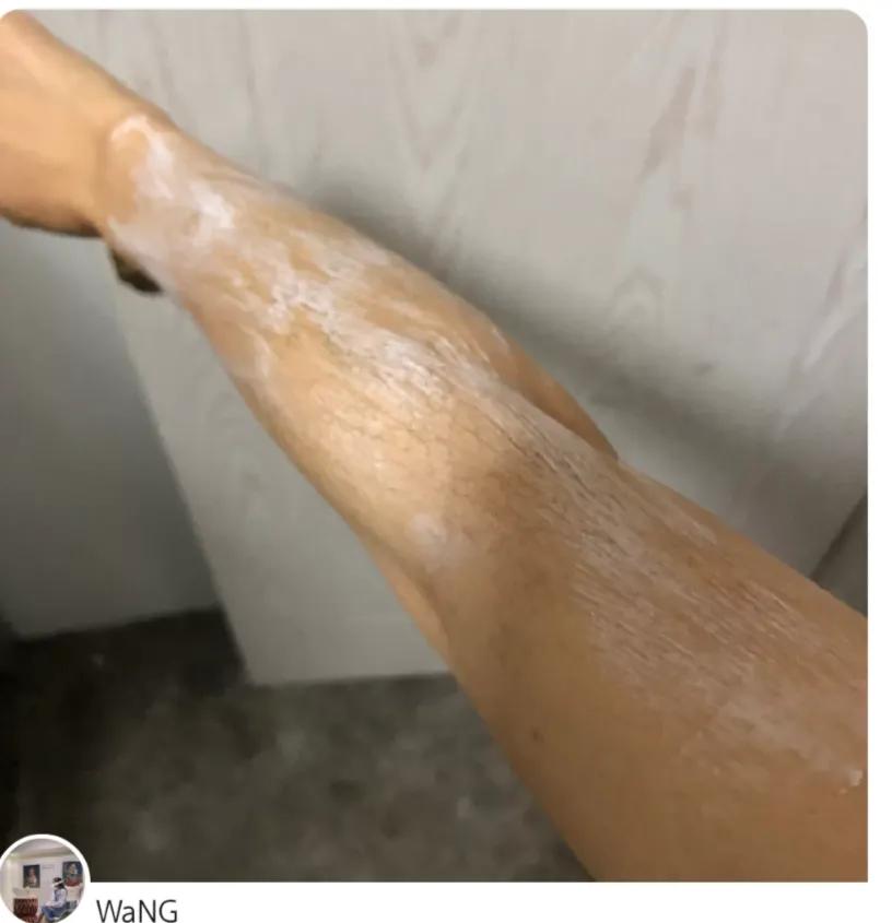 每个人的身上都有小毛毛,每个人的身上都有毛毛没有腿毛吗