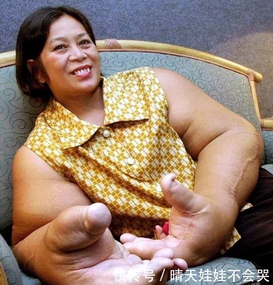 如此大的器官怎么长的，全都打破了吉尼斯记录，看到第一个我服了