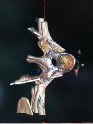 医院怎么确诊手汗症,广西手汗症治疗