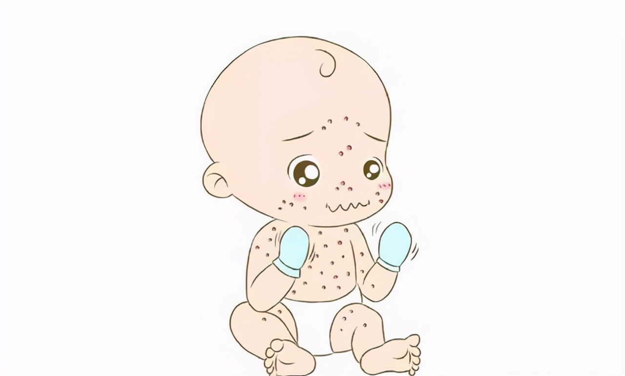 皮肤干燥过敏怎么办最快最有效,皮肤过敏好了起皮干燥紧绷怎么办