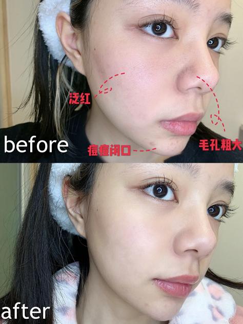 换季护肤面霜大牌,换季护肤大作战视频