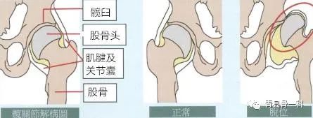 关节脱臼怎么预防,关节不小心扭到怎么休息