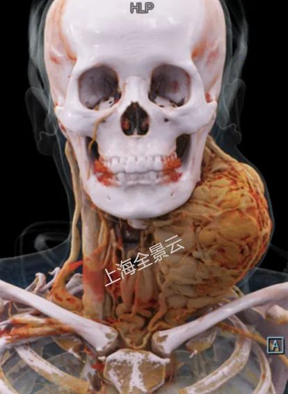 颈部肿块为什么有80%是肿瘤,颈部肿块1年没有变化