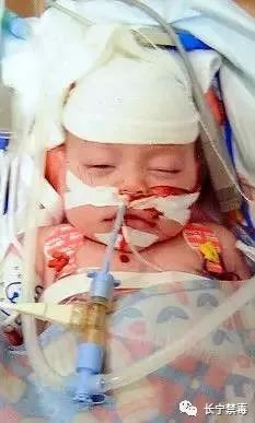 刚出生的婴儿被父母放进福尔马林,婴儿被偷偷注射毒品