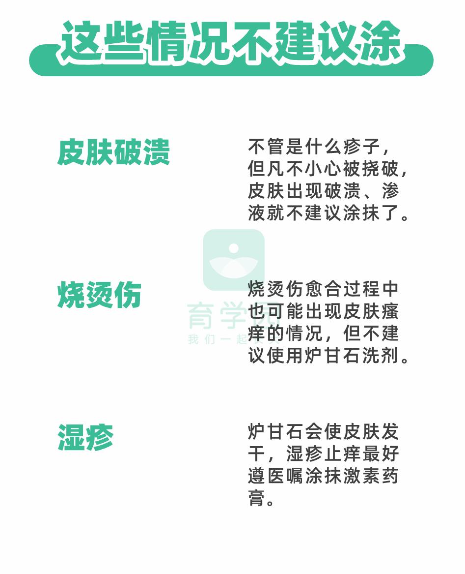 炉甘石四大禁忌,炉甘石可以大面积涂吗