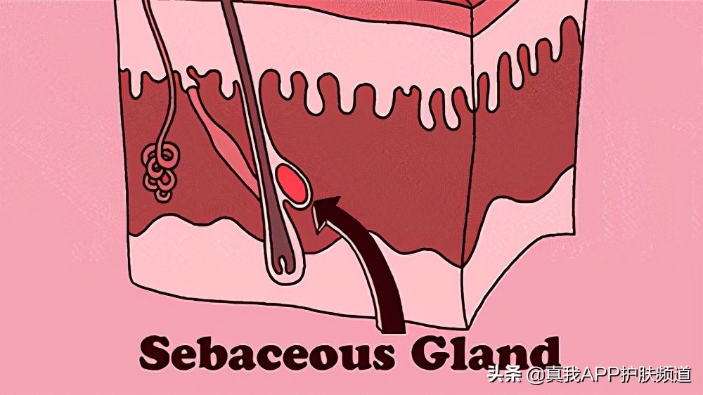 痘痘应该等它自己爆还是挤掉,长痘痘了要等它自己破掉吗