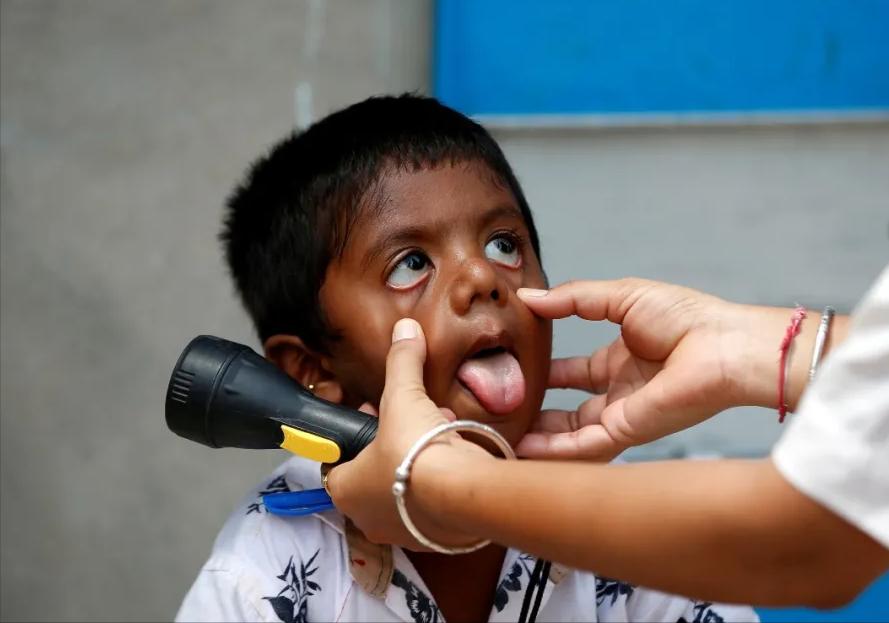 印度毒王最新信息,印度毒王视频