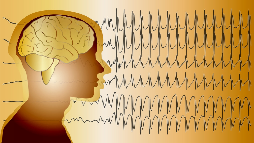 癫痫病早期的症状有哪些,癫痫病的早期症状是什么