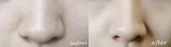 护肤反而皮肤差,改掉这些护肤恶习让你越变越美丽