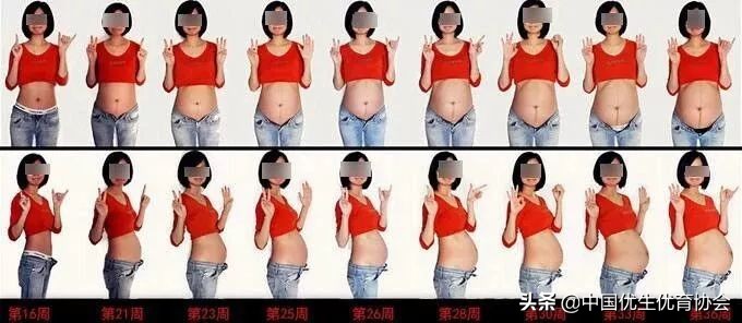 羊水穿刺孕妈,做羊水穿刺之后孕妈呼吸急促