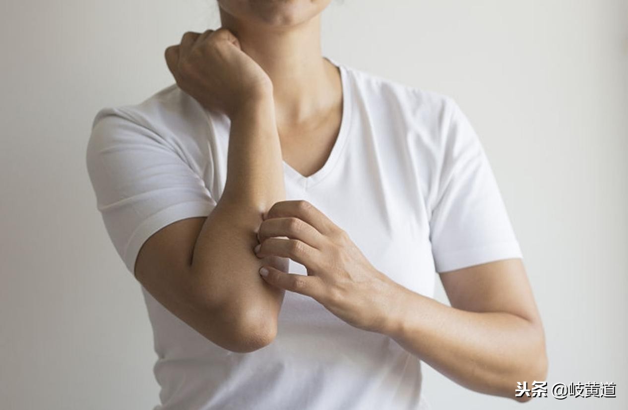 皮肤红色丘疹瘙痒,湿疹长小丘疹很严重吗