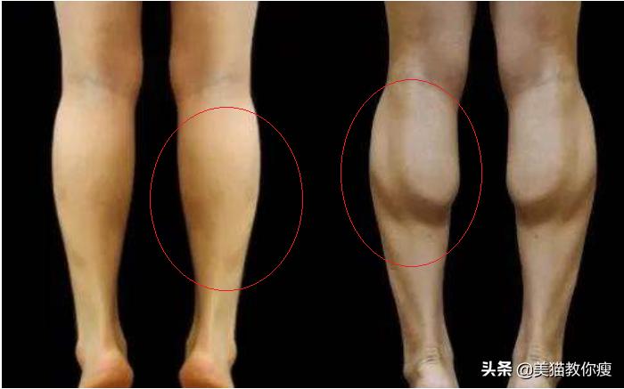 小学生肌肉腿怎么瘦成筷子腿,三天肌肉腿瘦成筷子腿