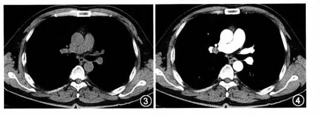 骨科医院拍片有哪几种,医院骨科拍片一般多少钱