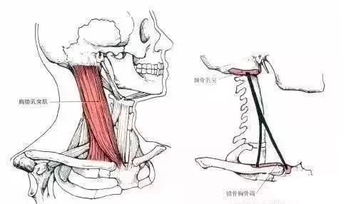 颈部胸锁乳突肌后部有结节,颈部胸锁乳突肌有一个包