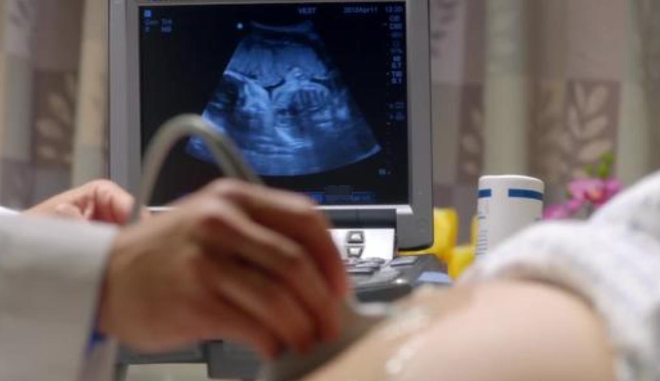 同房后倒立,能提高受孕几率?别让谣言祸害了,这样做才科学