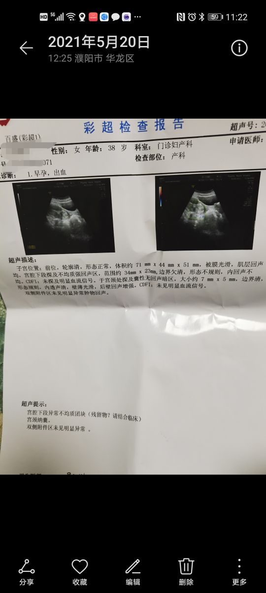 盆李小寨小媛怀孕四个月羊水流完，真的是公布早了吗？