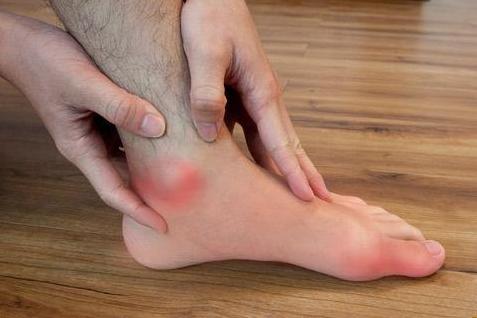 干细胞治疗痛风，远离折磨