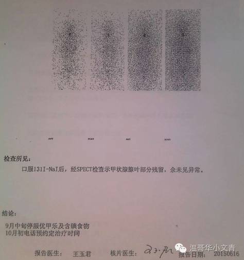 甲状腺癌存在过度治疗,被严重低估的甲状腺癌