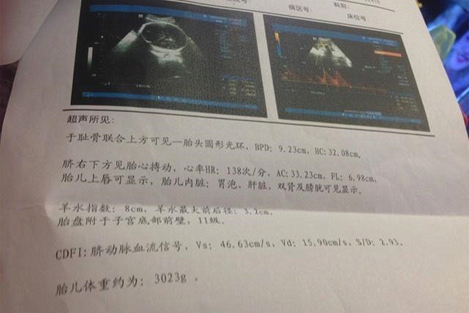 40岁产妇孕43周,43岁高龄孕期40周