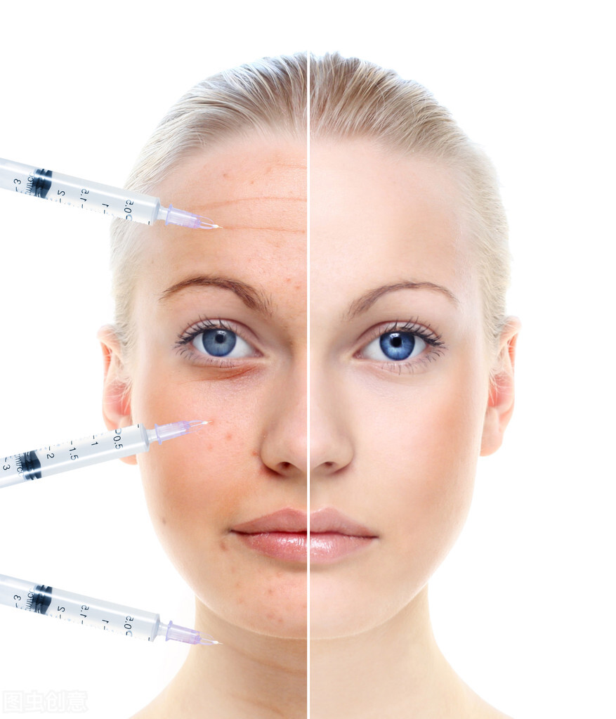 如何收缩毛孔最有效方法,毛孔粗大怎么才能有效地收缩毛孔