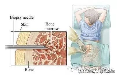 运城市第一医院肿瘤手术,运城市第一医院微创介入手术