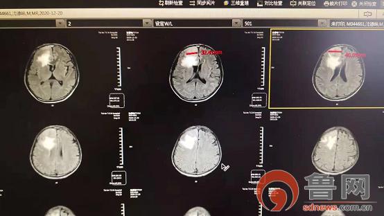 仁心济世救重患村医感恩送锦旗,医生妙手回春患者感激送锦旗