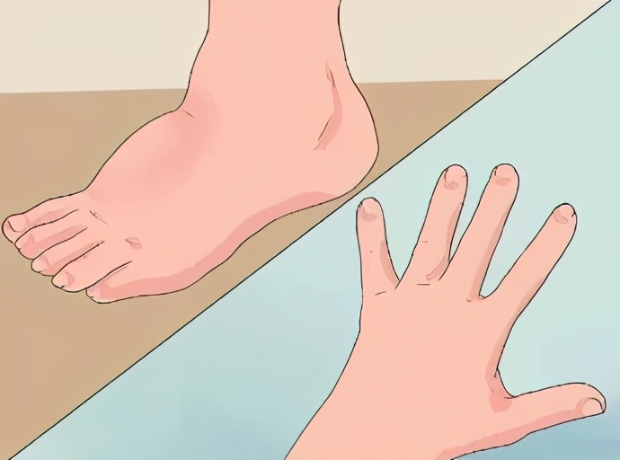 孕期常见身体不适与缓解方法,孕期胃部不适如何缓解