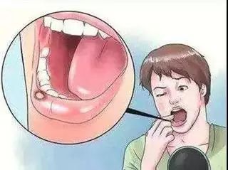 维生素b保健产品有用吗,维生素b护肝神器