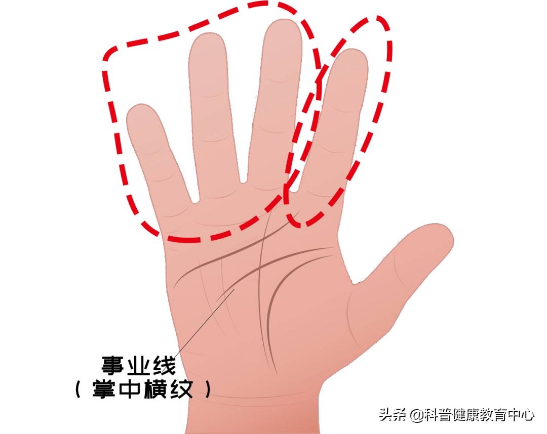 手相的科学解释,从医学角度解读手相的秘密