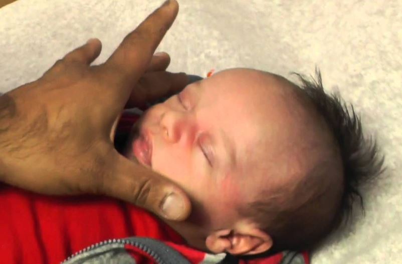 宝宝红眼病好的征兆,新生宝宝眼睛有点黄是怎么回事