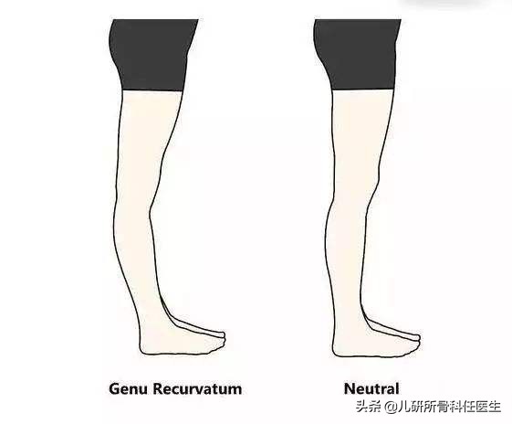 孩子出门玩耍担心牵拉肘？爸爸妈妈看这一篇就够了