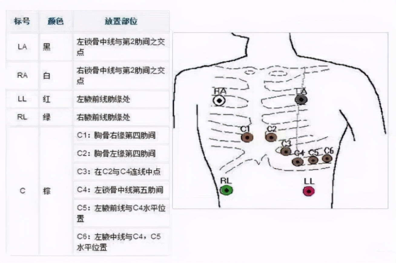 心电监护使用的收费标准,心电监护使用年限