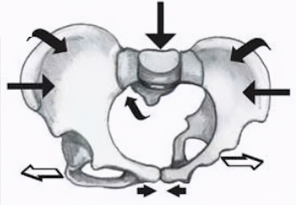 生宝宝选择剖腹产也需要做盆底肌修复，越早越好莫拖延