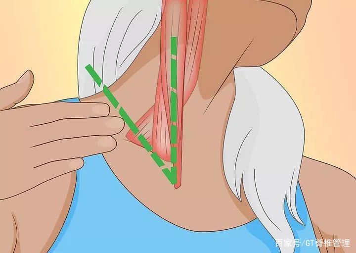 睡醒后脖子僵硬酸痛怎么缓解,起床后肩膀脖子酸痛如何缓解