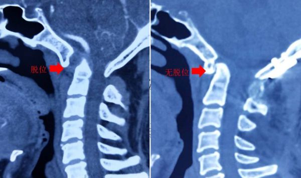 清风计划项目,清风计划靠谱吗