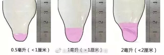 精子质量好坏怎么判断,精子质量好坏怎么判定