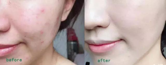 沈梦辰化妆后皮肤图,沈梦辰黑妹化妆