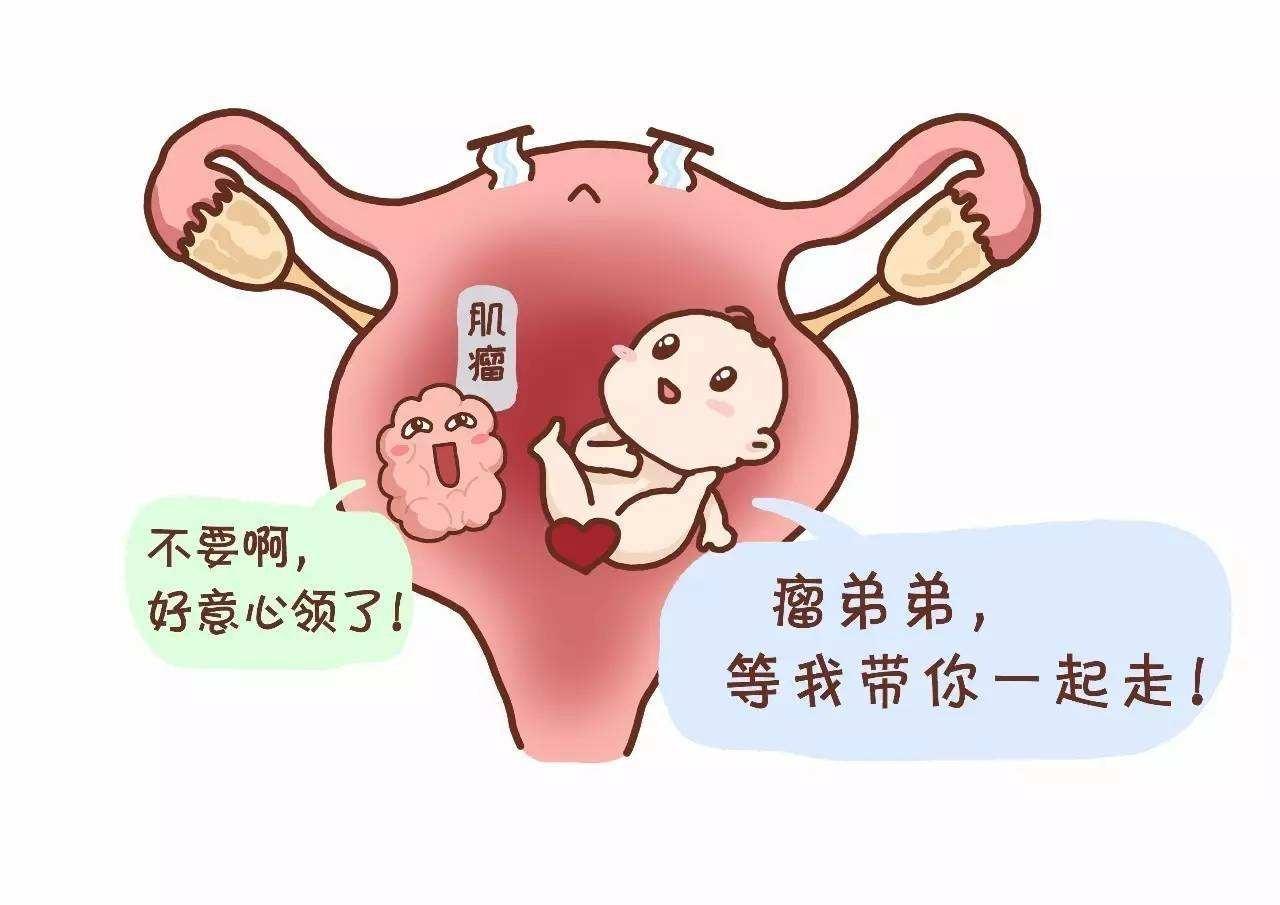 子宫肌瘤对怀孕的影响有多大？需要做手术吗？