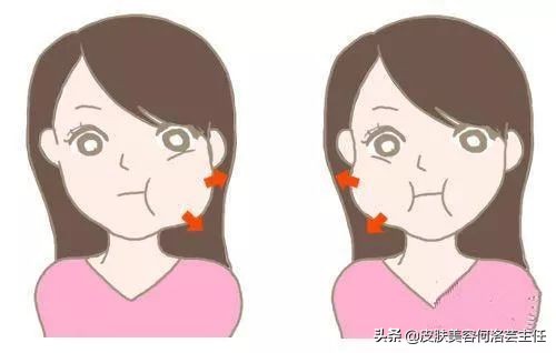 日式小颜整骨术靠谱吗,小颜整骨会有后遗症吗