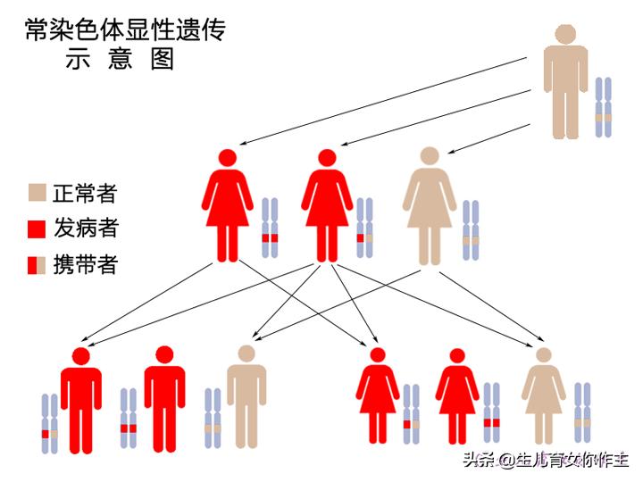 备孕前有染色体异常怎么办,备孕要注意哪些遗传病史