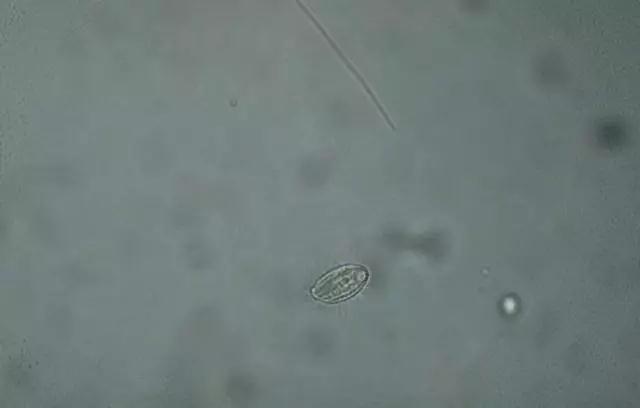 收藏!24种污水处理微生物菌相及指导意义,环保人必看(多图)