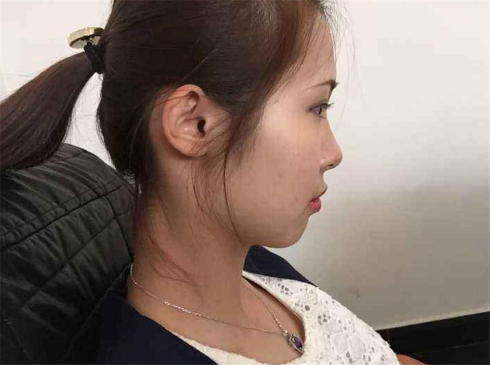 5岁后脑勺平怎么补救,女孩后脑勺平