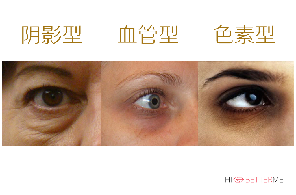 黑眼圈真正有用的眼霜,对付黑眼圈最好用的眼霜