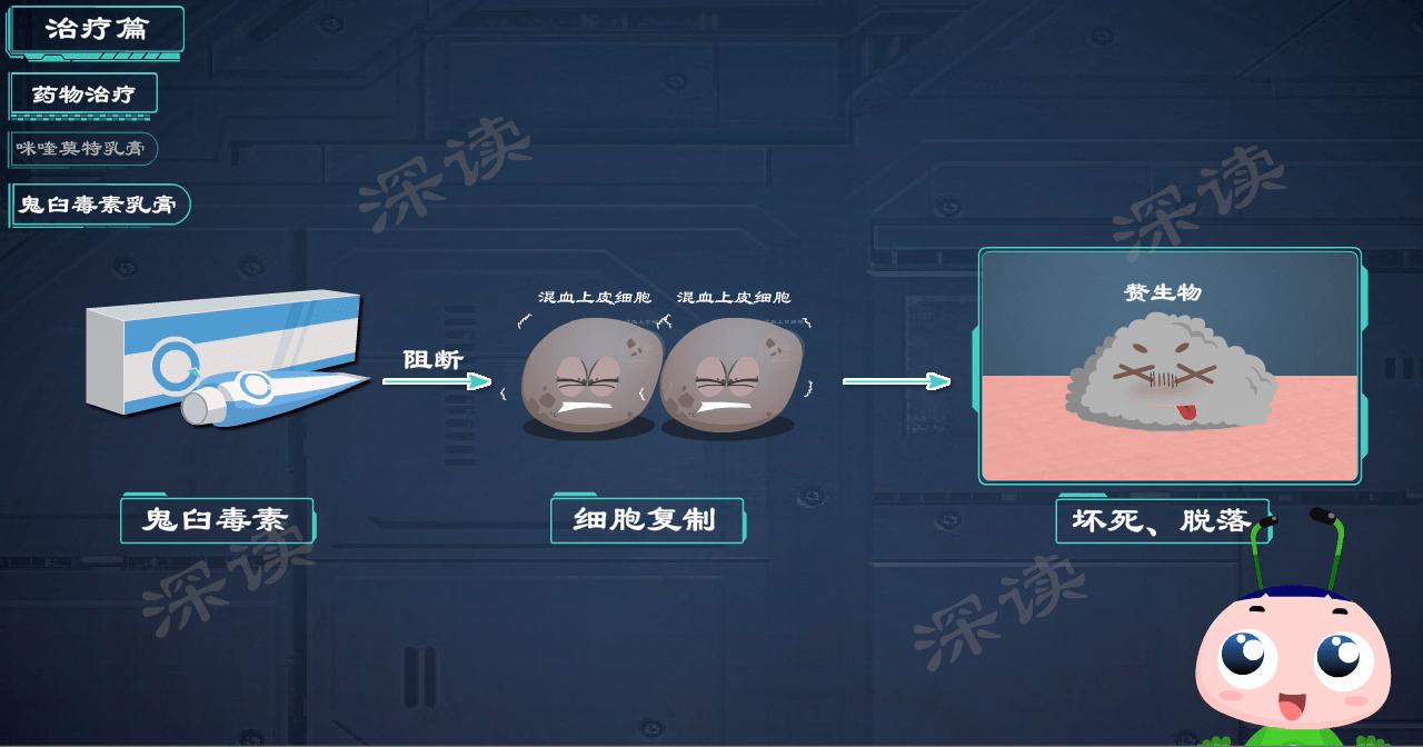 液氮冷冻治疗尖锐湿疣没感觉,液氮冷冻治疗尖锐湿疣注意事项