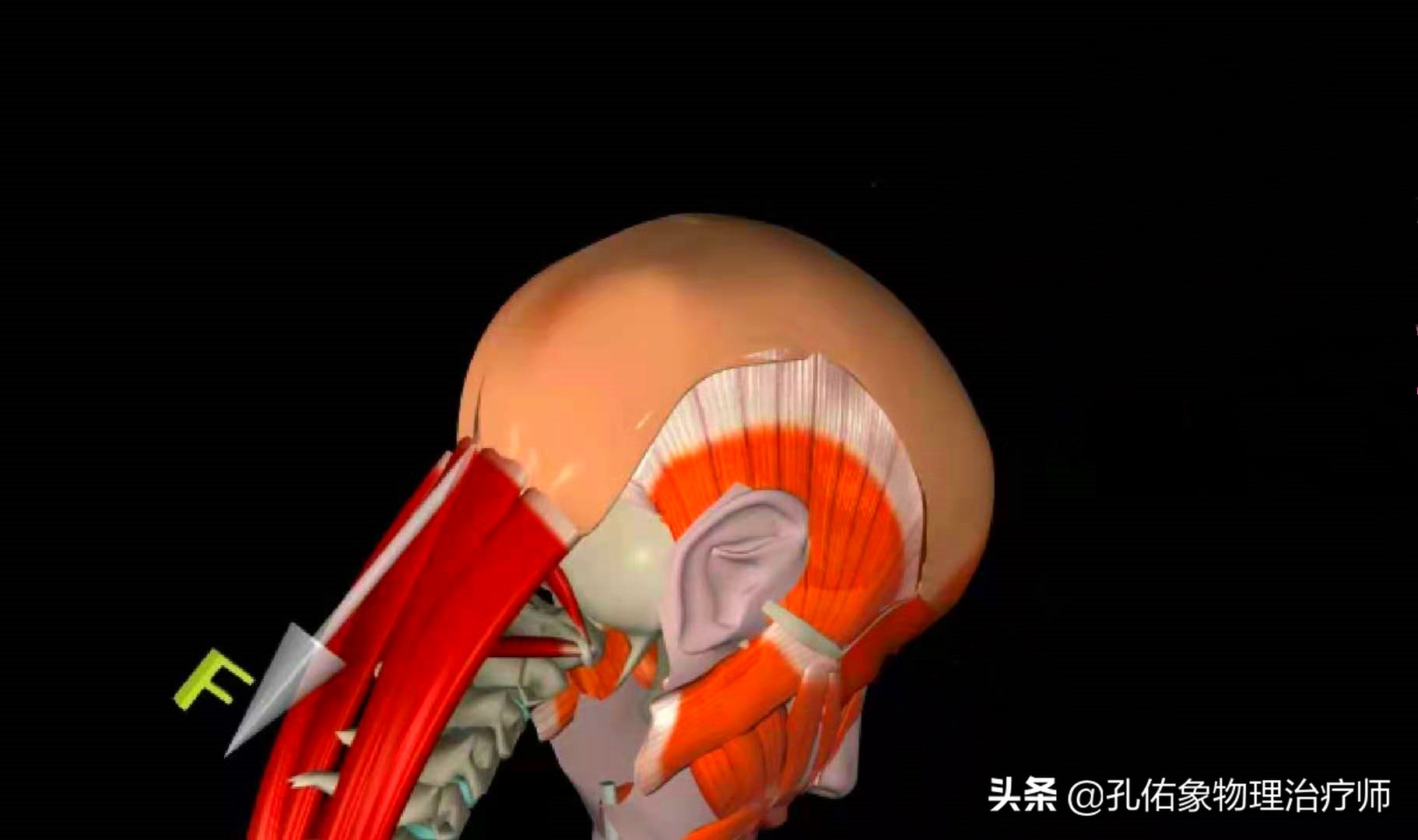 颈椎间盘突出手指尖麻乏力怎么治,颈椎间盘突出导致四肢无力疼痛