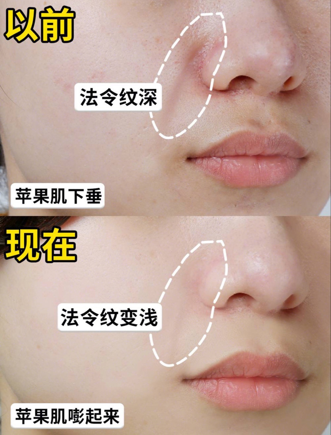 能抗氧美白的面膜,能够抗衰老的面膜