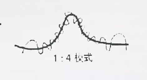 顺产和剖宫产都经历过的感受,剖宫产和顺产哪个疼