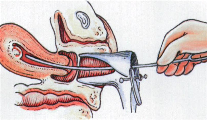 肚子里能长“巧克力”？没有骗人，是真的！