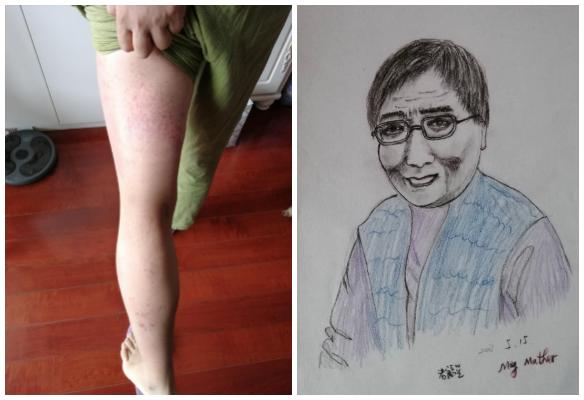 拍打膀胱有什么好处,拍打膀胱有助排尿吗